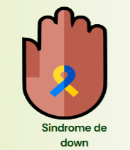 sindrome de down